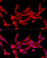 c-Cbl Antibody in Immunocytochemistry (ICC/IF)