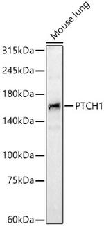 PTCH Antibody in Western Blot (WB)