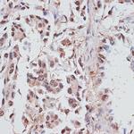 RPA70 Antibody in Immunohistochemistry (Paraffin) (IHC (P))