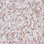 RPA70 Antibody in Immunohistochemistry (Paraffin) (IHC (P))