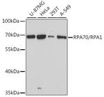 RPA70 Antibody in Western Blot (WB)