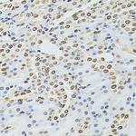 ILK Antibody in Immunohistochemistry (Paraffin) (IHC (P))