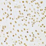 ILK Antibody in Immunohistochemistry (Paraffin) (IHC (P))