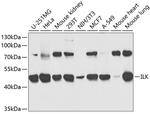 ILK Antibody in Western Blot (WB)