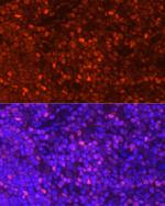 LEF1 Antibody in Immunocytochemistry (ICC/IF)