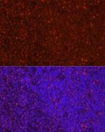 LEF1 Antibody in Immunocytochemistry (ICC/IF)