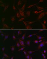 NSF Antibody in Immunocytochemistry (ICC/IF)