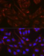 NSF Antibody in Immunocytochemistry (ICC/IF)