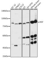 NSF Antibody in Western Blot (WB)