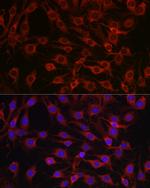 MARCKS Antibody in Immunocytochemistry (ICC/IF)