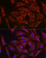 MARCKS Antibody in Immunocytochemistry (ICC/IF)