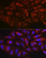 MARCKS Antibody in Immunocytochemistry (ICC/IF)