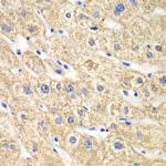 ACADS Antibody in Immunohistochemistry (Paraffin) (IHC (P))