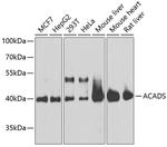 ACADS Antibody in Western Blot (WB)