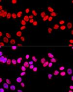 SFPQ Antibody in Immunocytochemistry (ICC/IF)