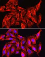 Caspase 1 Antibody in Immunocytochemistry (ICC/IF)