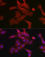 Cathepsin B Antibody in Immunocytochemistry (ICC/IF)