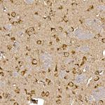 Cathepsin B Antibody in Immunohistochemistry (Paraffin) (IHC (P))