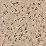 Cathepsin B Antibody in Immunohistochemistry (Paraffin) (IHC (P))