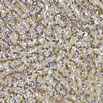 Cathepsin B Antibody in Immunohistochemistry (Paraffin) (IHC (P))