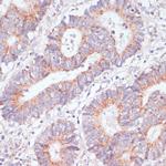 RAP1A Antibody in Immunohistochemistry (Paraffin) (IHC (P))