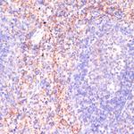 RAP1A Antibody in Immunohistochemistry (Paraffin) (IHC (P))