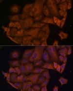 beta Arrestin 1 Antibody in Immunocytochemistry (ICC/IF)