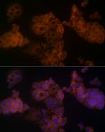 beta Arrestin 1 Antibody in Immunocytochemistry (ICC/IF)