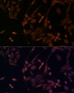 beta Arrestin 1 Antibody in Immunocytochemistry (ICC/IF)