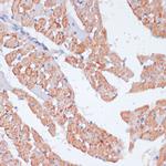 beta Arrestin 1 Antibody in Immunohistochemistry (Paraffin) (IHC (P))