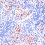 beta Arrestin 1 Antibody in Immunohistochemistry (Paraffin) (IHC (P))