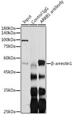 beta Arrestin 1 Antibody in Immunoprecipitation (IP)