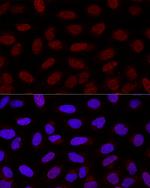 YAP1 Antibody in Immunocytochemistry (ICC/IF)