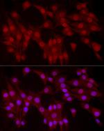 YAP1 Antibody in Immunocytochemistry (ICC/IF)