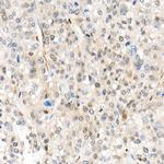 YAP1 Antibody in Immunohistochemistry (Paraffin) (IHC (P))