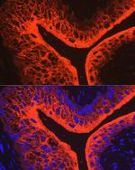 UPK3A Antibody in Immunohistochemistry (Paraffin) (IHC (P))