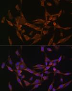 UBE2O Antibody in Immunocytochemistry (ICC/IF)