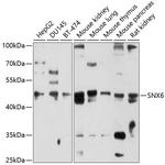 SNX6 Antibody in Western Blot (WB)