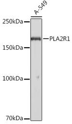 PLA2R1 Antibody in Western Blot (WB)