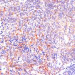 ROCK1 Antibody in Immunohistochemistry (Paraffin) (IHC (P))