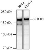 ROCK1 Antibody in Western Blot (WB)