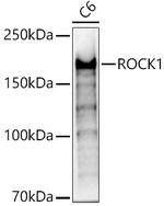 ROCK1 Antibody in Western Blot (WB)