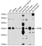 ATP4B Antibody in Western Blot (WB)