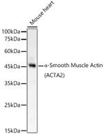 Alpha-Smooth Muscle Actin Antibody in Western Blot (WB)