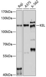 KELL Antibody in Western Blot (WB)