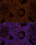 ZP2 Antibody in Immunocytochemistry (ICC/IF)