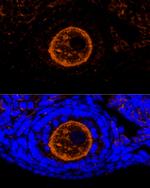 ZP2 Antibody in Immunocytochemistry (ICC/IF)