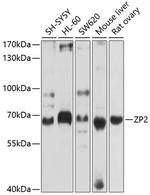 ZP2 Antibody in Western Blot (WB)