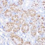 alpha-1 Antitrypsin Antibody in Immunohistochemistry (Paraffin) (IHC (P))