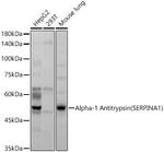 alpha-1 Antitrypsin Antibody in Western Blot (WB)